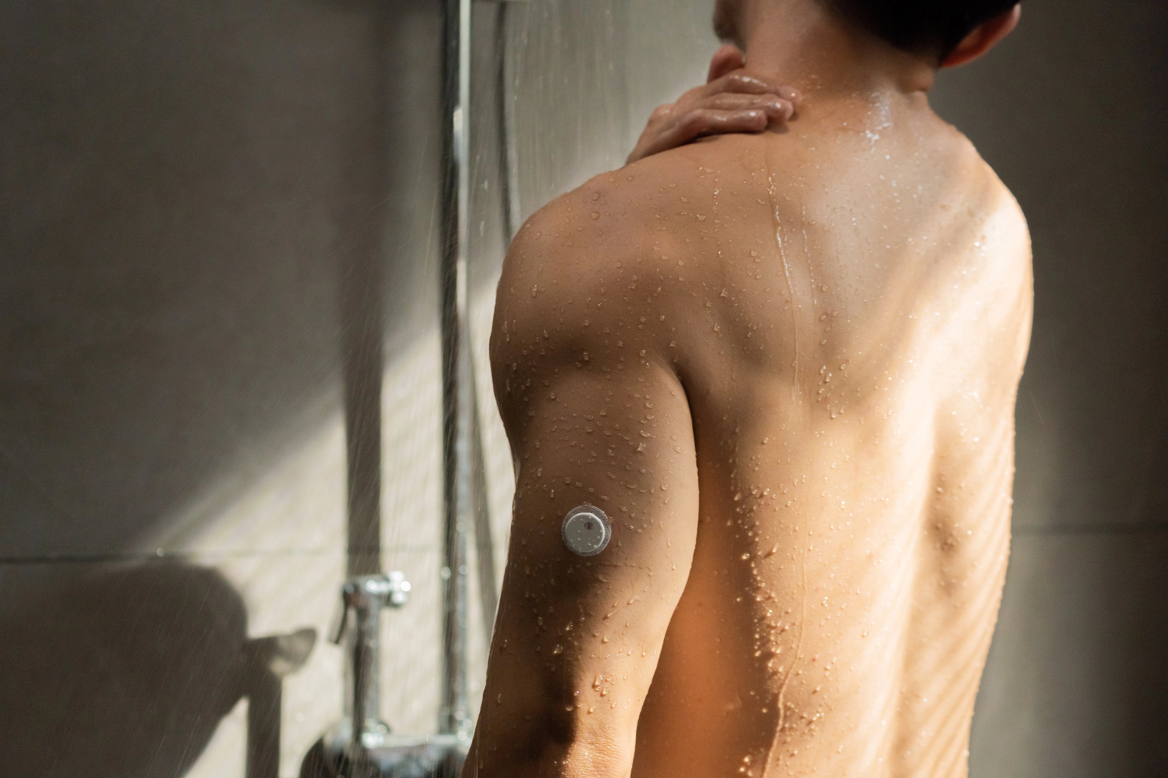 Linx folyamatos szöveti glükózmonitor (CGM) szenzor