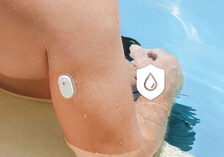 SIBIONICS GS1 folyamatos glükóz monitor 5 percenkénti méréssel